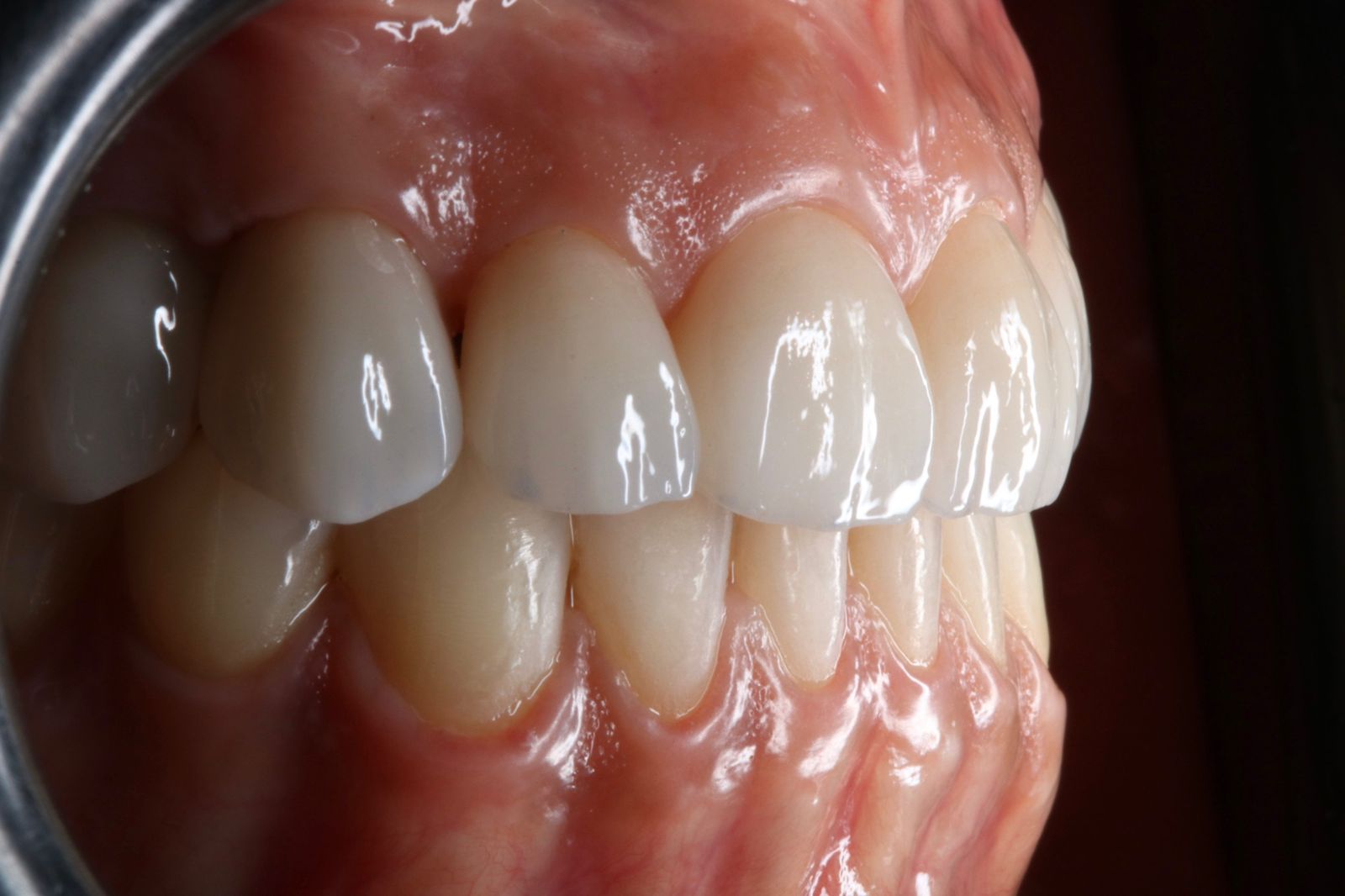 Resultado de tratamento odontológico 3